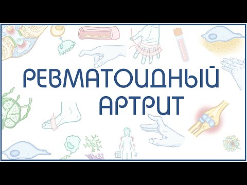 Видео: Ревматоидный артрит - причины, патогенез - в схемах и рисунках