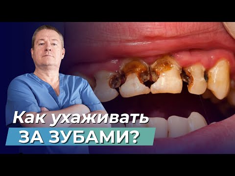 Видео: ГИГИЕНА ЗУБОВ: как правильно ухаживать за полостью рта?