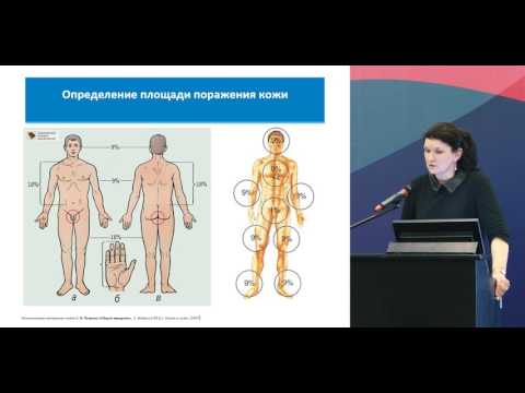 Видео: Взгляд дерматолога на проблему кожной токсичности: коррекция дерматологических реакций