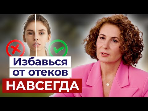 Видео: Замучали отеки? Способ ИЗБАВИТЬСЯ от них НАВСЕГДА!