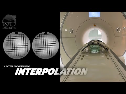 Видео: ИНТЕРПОЛЯЦИЯ МРТ – ЛУЧШЕЕ ПОНИМАНИЕ