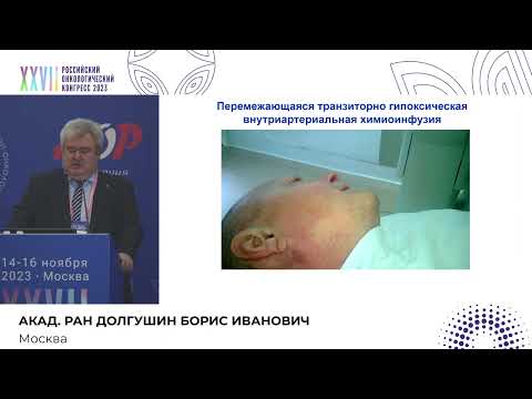 Видео: Интраартериальные технологии лечения плоскоклеточного рака головы и шеи