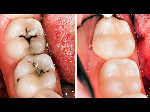 Видео: 10 Простых Секретов Здоровой Улыбки