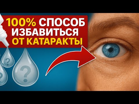 Видео: СЕКРЕТЫ ОФТАЛЬМОЛОГА О КАТАРАКТЕ! Вернуть зрение быстро и просто.