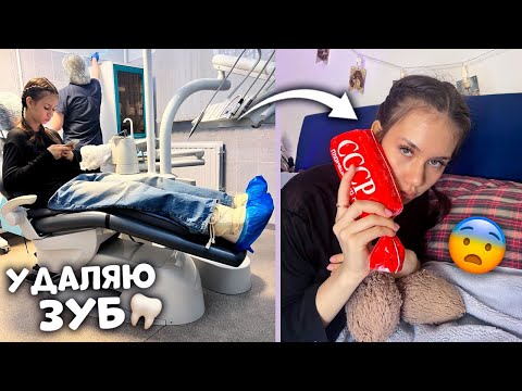 Видео: Удалила ЗУБ МУДРОСТИ 😭 мои ВПЕЧАТЛЕНИЯ