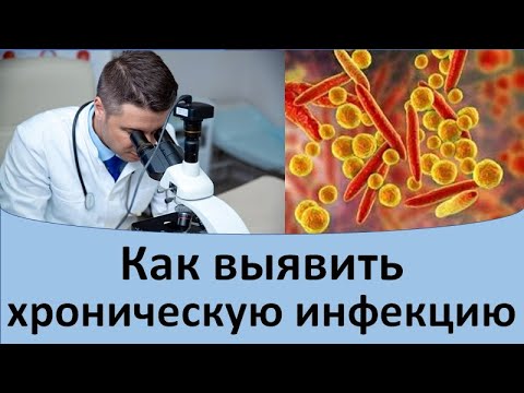 Видео: Как выявить хроническую инфекцию