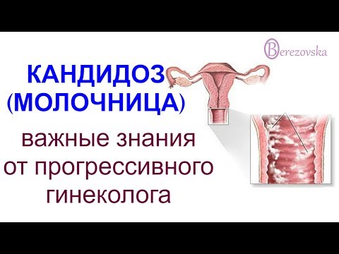 Видео: О кандидозе (молочнице) @Dr. Olena Berezovska