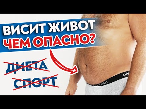 Видео: Как убрать живот? / К каким проблемам приводит обвисший живот?