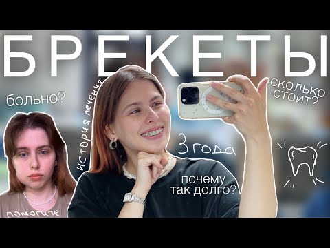 Видео: БРЕКЕТЫ: моя история лечения в 3 года
