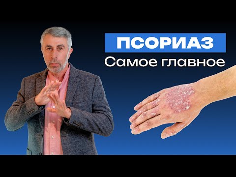 Видео: ПСОРИАЗ. Самое главное