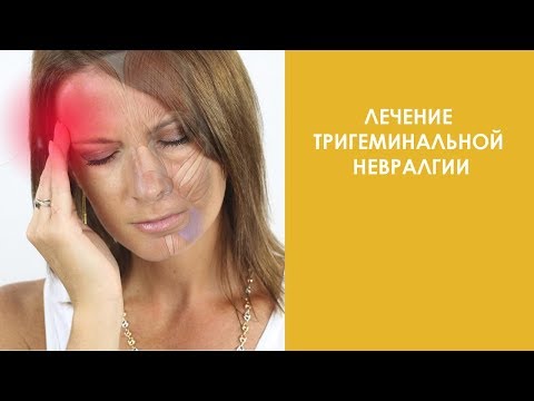 Видео: Лечение тригеминальной невралгии