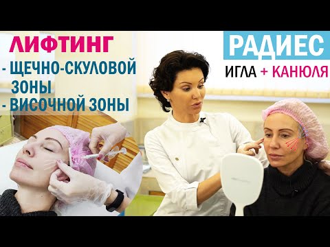 Видео: Инъекции Радиес. Косметолог Зайцева Варвара сделает процедуру и подробно расскажет про нее