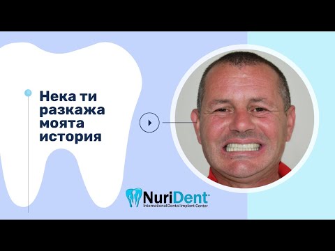 Видео: Екстракция на всички зъби и безболезнено поставяне на зъбни импланти