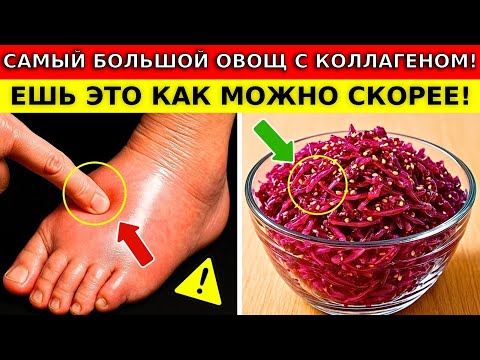 Видео: ПРОЩАЙ, отёки! 8 овощей с коллагеном для здоровья НОГ и СУСТАВОВ | Здоровье пожилых