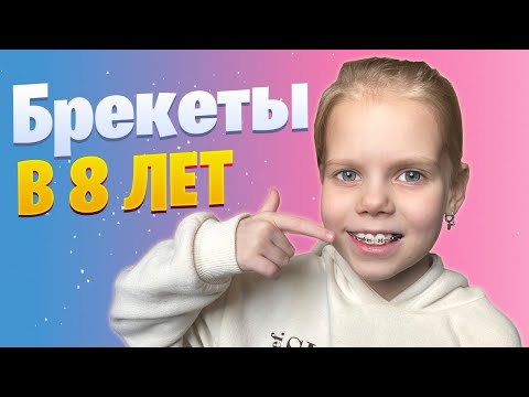 Видео: Установка брекет системы в 8 лет | Виталина поставила брекеты | Семейный влог Долгов Фемели