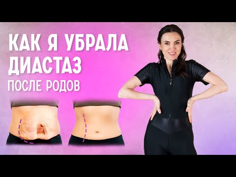 Видео: Восстановление после родов | Упражнения от диастаза
