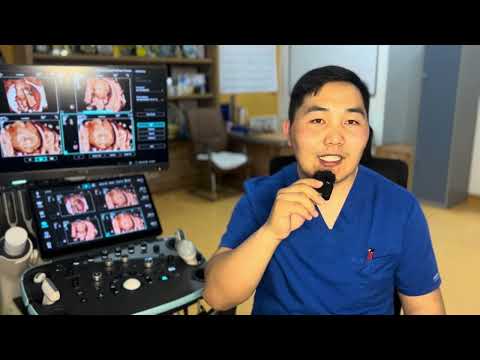 Видео: 28-29 долоо хоногтой жирэмсэн бол үзээрэй