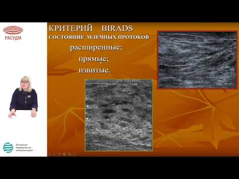 Видео: УЗД редких и часто встречаемых изменений в молочных железах