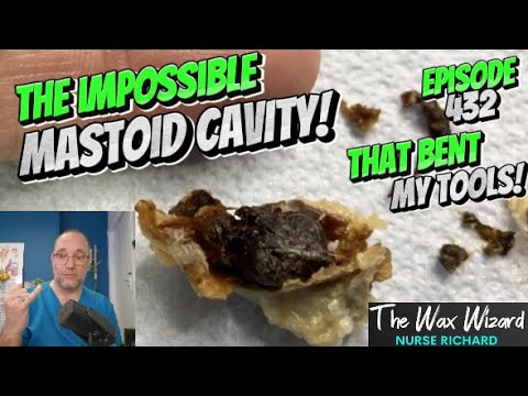Видео: НЕВОЗМОЖНАЯ СОСЦЕВИДНАЯ ПОЛОСТЬ! (из-за которой погнулись мои инструменты!) Эпизод 432