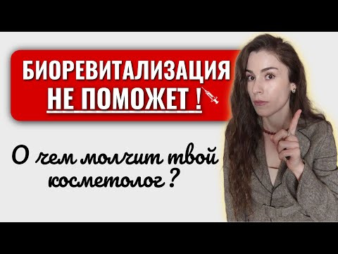 Видео: НЕ ДЕЛАЙ БИОРЕВИТАЛИЗАЦИЮ! Правда, которую тебе не скажут косметологи