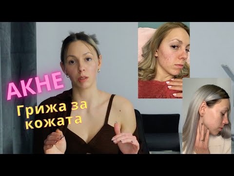 Видео: АКНЕ | За реакциите на кожата и нейната грижа - Част 1