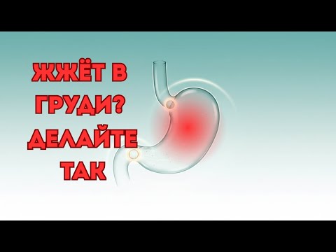 Видео: «Два простых способа избавиться от изжоги и рефлюкса без таблеток».