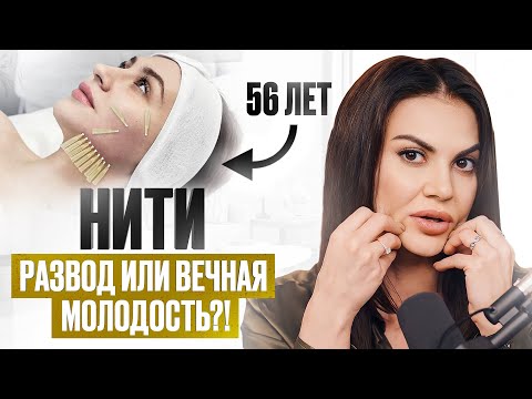 Видео: Опасность НИТЕВОГО ЛИФТИНГА: непредвиденные последствия