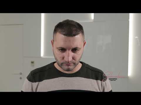 Видео: Трансплантация на коса при д-р Евгени Шарков