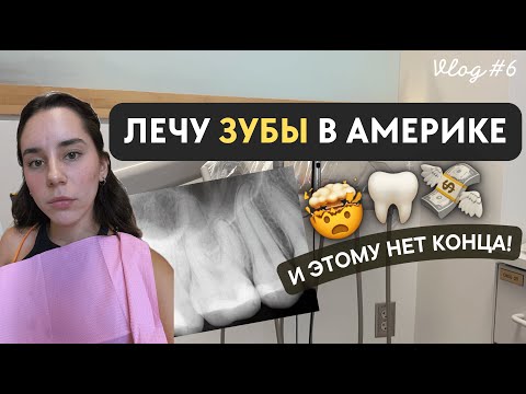 Видео: Лечение зубов в Америке - удаление нерва, цены, стоит ли? | USA Vlog #6