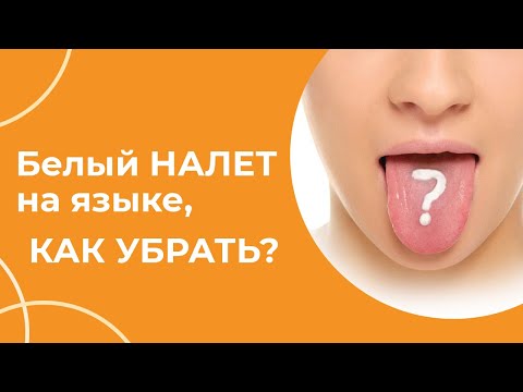 Видео: Белый НАЛЕТ на языке, как убрать? | Огулов А.Т.