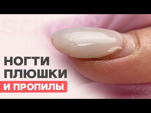 Видео: ТОЛСТЫЕ ногти ПЛЮШКИ и ПРОПИЛЫ | Ошибки маникюра