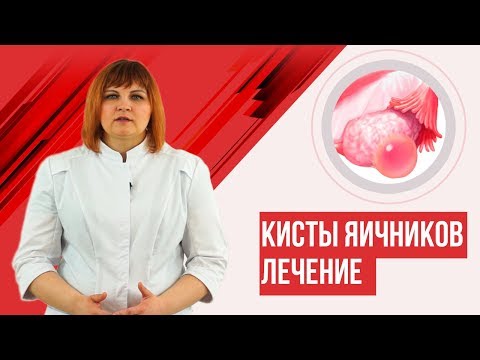 Видео: Киста яичника. Лечить? Или сама исчезнет?