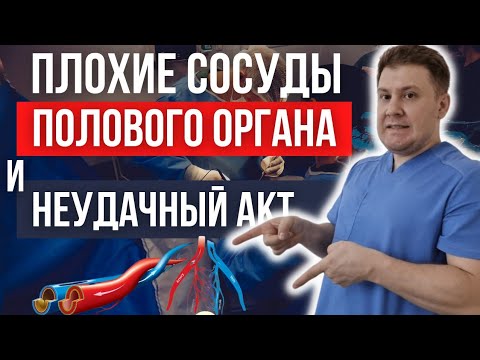Видео: ПЛОХИЕ сосуды полового органа. Как ИСПРАВИТЬ