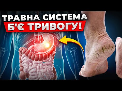 Видео: Не ігноруй ЦІ сигнали! ПРОСТИЙ СПОСІБ перевірити роботу шлунково-кишкового тракту
