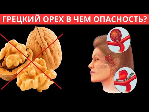 Видео: ВРАЧ: Грецкий Орех КРАЙНЕ ПРОТИВОПОКАЗАН людям с... ЧТО ТВОРИТ ГРЕЦКИЙ ОРЕХ?