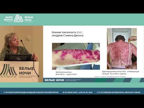Видео: Практические аспекты иммунотерапии солидных опухолей (Проценко С.А.)
