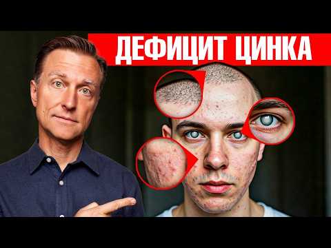 Видео: 7 признаков дефицита цинка, которые превратят вашу жизнь в АД😲