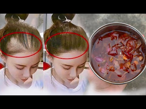 Видео: Нанесла это средство и мои волосы растут как сумасшедшие и больше не выпадают! Уже через 1 месяц!