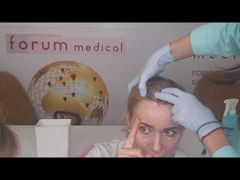 Видео: 25.02 Токсин верх. Разметка(на мне).