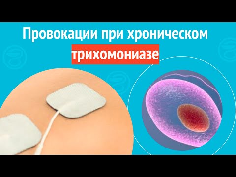Видео: ✔️ Провокации при хроническом трихомониазе. Клинический случай №1619