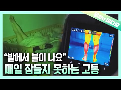 Видео: Женщина, живущая в жгучей боли