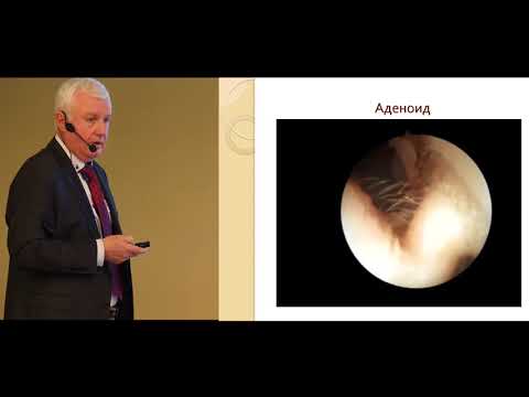 Видео: Етіологія та патогенез секреторного отиту
