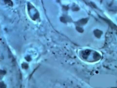 Видео: Споровики: грегарины, кокцидии, токсоплазма, малярийный плазмодий