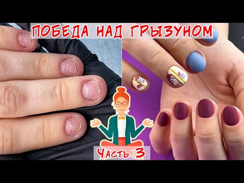 Видео: Восстановление обкусанных ногтей / Часть 3 / Ремонт трещины на ногте