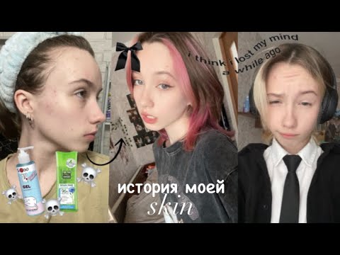 Видео: my skin story🍚||чем я пользовалась раньше??