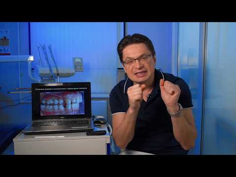 Видео: Восстановление выбитого клыка - Как создать клыковое ведение на Вашей реставрации!