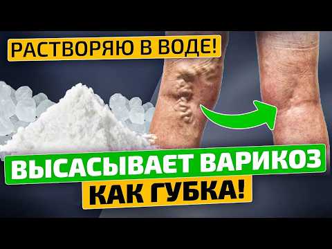 Видео: Об этом средстве забыли! Мощный киллер варикоза, боли в ногах, отеков и усталости!