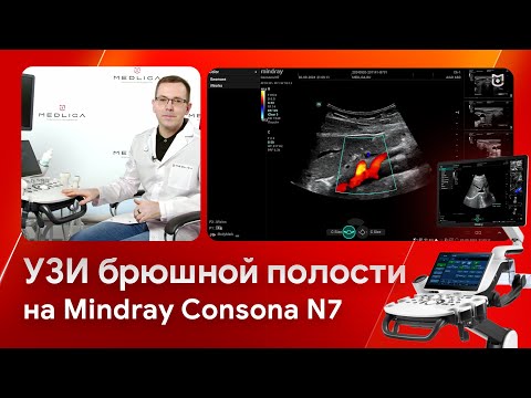 Видео: УЗИ брюшной полости и оценка жирового гепатоза на Mindray Consona N7
