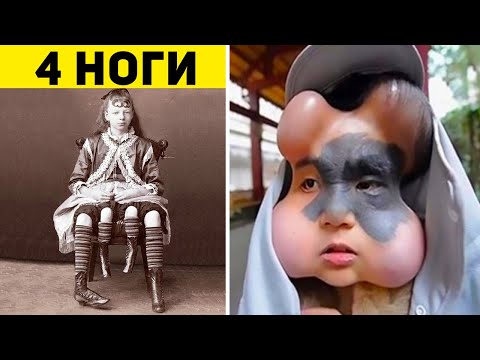 Видео: 20 Людей, в Существование Которых Вы Не Поверите, Пока Не Увидите