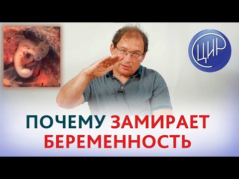 Видео: Причины замершей беременности. Почему происходит остановка развития беременности. Гузов И.И.